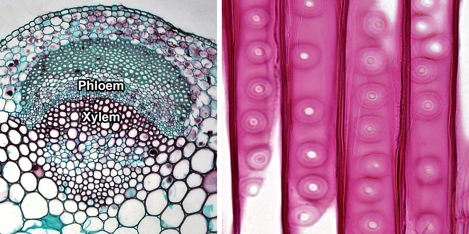 SOLVED: Ranunculus slide. Identify the following structures/tissues and  label them on the figures below: epidermis, cortex; pith, vascular bundles,  xylem; vascular cambium, phloem, and sclerenchyma (bundle cap fibers).  Epidermis Cortex Phloem Xylem